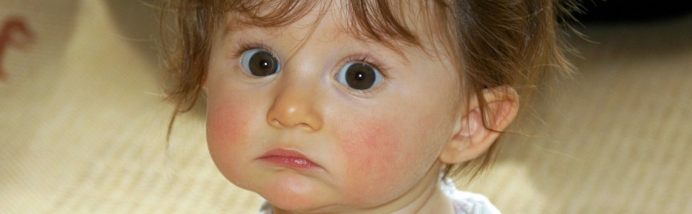 Czy dzieci z atopowym zapaleniem skóry należy kierować do alergologa?