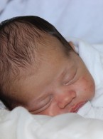 Jak leczyć trądzik niemowlęcy?